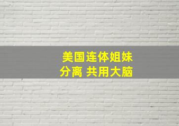 美国连体姐妹分离 共用大脑